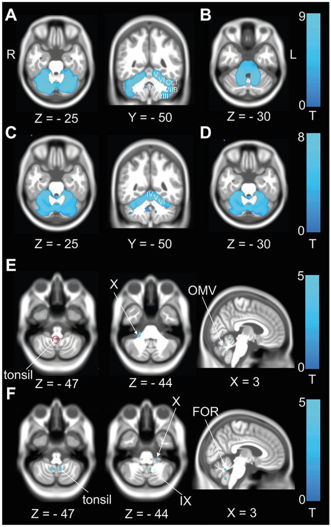 https://cdn.ncbi.nlm.nih.gov/pmc/blobs/5efc/10576698/69f7b9ded07d/415_2023_11859_Fig1_HTML.jpg