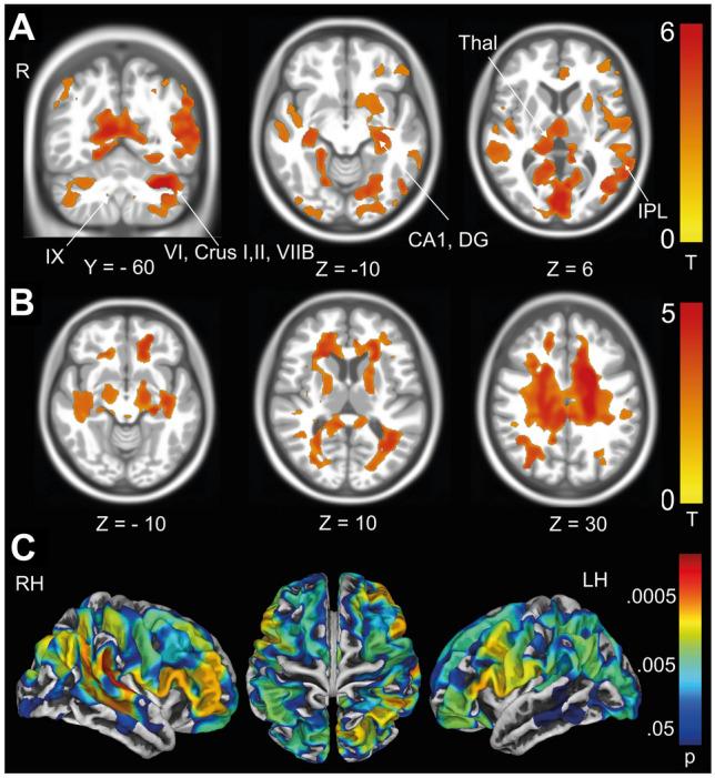 https://cdn.ncbi.nlm.nih.gov/pmc/blobs/5efc/10576698/a3fd59e854a8/415_2023_11859_Fig4_HTML.jpg