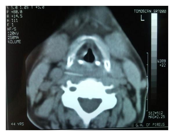 https://cdn.ncbi.nlm.nih.gov/pmc/blobs/5efd/3236489/f034a4d0a76d/IJOL2011-274102.001.jpg
