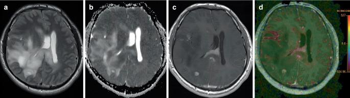 https://cdn.ncbi.nlm.nih.gov/pmc/blobs/5f01/10449995/104ab74e2456/62_2023_1277_Fig1_HTML.jpg