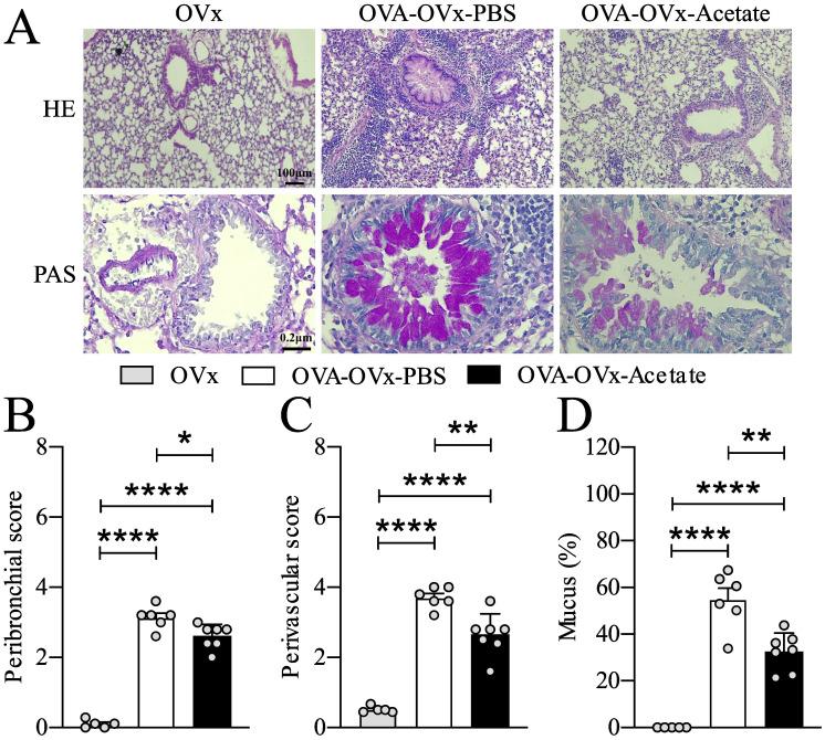 https://cdn.ncbi.nlm.nih.gov/pmc/blobs/5f02/12023485/00b75096ca9b/fcimb-15-1543822-g002.jpg