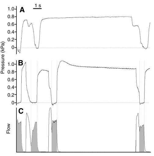 https://cdn.ncbi.nlm.nih.gov/pmc/blobs/5f03/3160820/3d7c8f3249d9/JEB051110F6.jpg