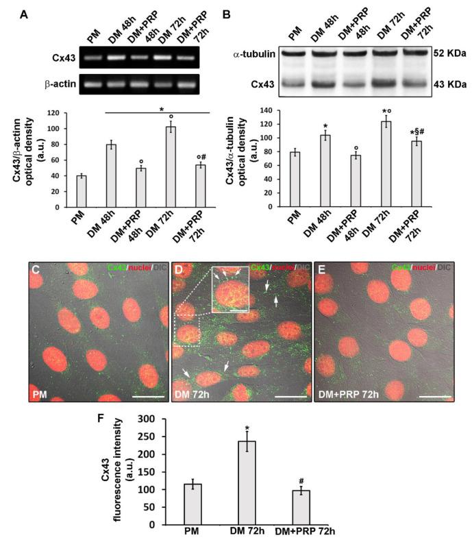 https://cdn.ncbi.nlm.nih.gov/pmc/blobs/5f07/7290305/52a4b74420e4/cells-09-01199-g008.jpg