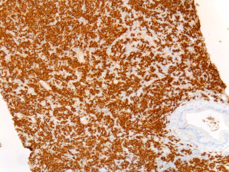 https://cdn.ncbi.nlm.nih.gov/pmc/blobs/5f0b/7478767/077f1c1495f5/cureus-0012-00000009583-i02.jpg