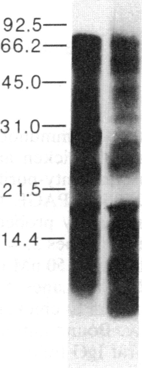 https://cdn.ncbi.nlm.nih.gov/pmc/blobs/5f10/304257/44ca987b1308/pnas00267-0285-f.jpg
