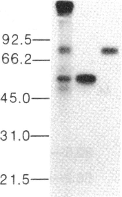 https://cdn.ncbi.nlm.nih.gov/pmc/blobs/5f10/304257/fabf53dacd15/pnas00267-0285-b.jpg