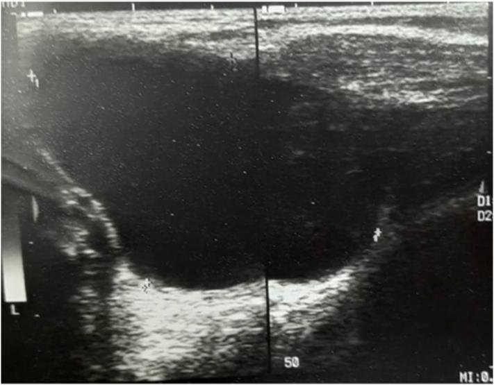 https://cdn.ncbi.nlm.nih.gov/pmc/blobs/5f11/9758516/3ea3a5a3aebf/gr2.jpg