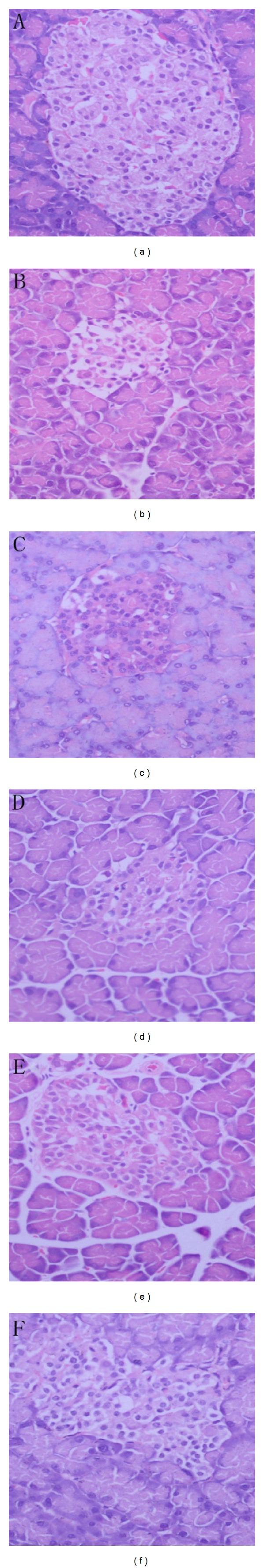 https://cdn.ncbi.nlm.nih.gov/pmc/blobs/5f1f/3821916/f3c65dd3a285/ECAM2013-125416.005.jpg