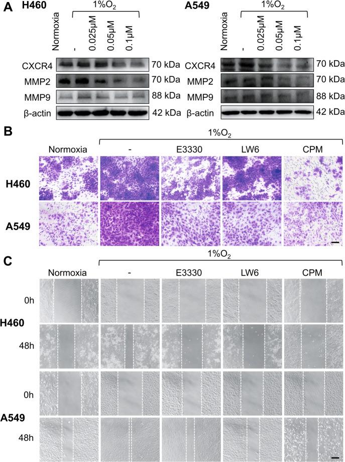 https://cdn.ncbi.nlm.nih.gov/pmc/blobs/5f1f/8121842/e7858333eb9c/41419_2021_3771_Fig5_HTML.jpg