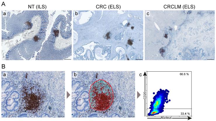 https://cdn.ncbi.nlm.nih.gov/pmc/blobs/5f22/7692185/042f5bfb729e/cancers-12-03117-g002.jpg