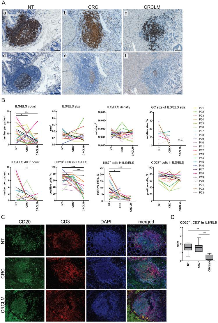 https://cdn.ncbi.nlm.nih.gov/pmc/blobs/5f22/7692185/73f406c15021/cancers-12-03117-g004.jpg