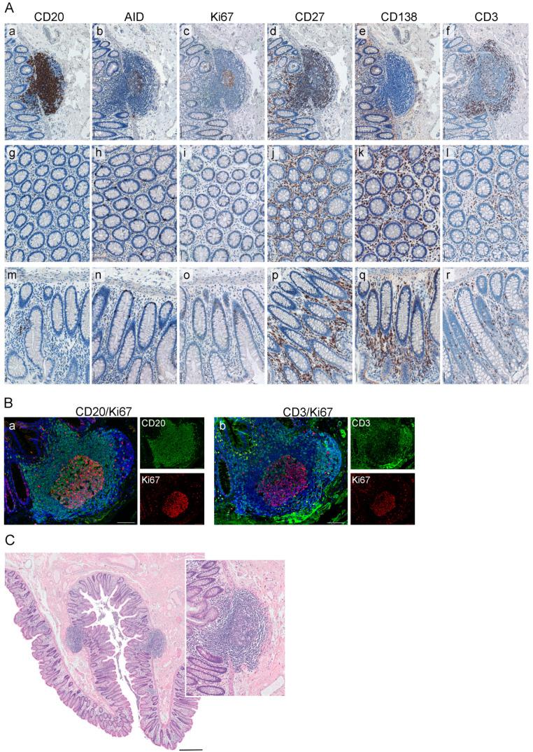 https://cdn.ncbi.nlm.nih.gov/pmc/blobs/5f22/7692185/df06540e7337/cancers-12-03117-g003.jpg