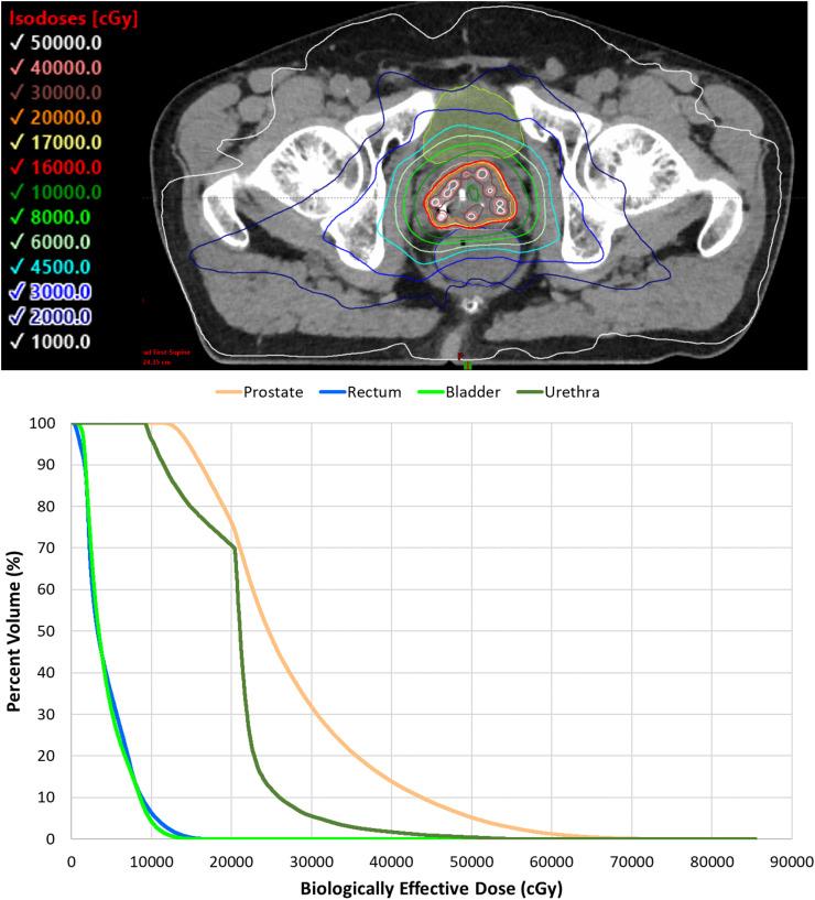 https://cdn.ncbi.nlm.nih.gov/pmc/blobs/5f2c/9991539/b289393af257/gr2.jpg