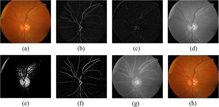 https://cdn.ncbi.nlm.nih.gov/pmc/blobs/5f32/7346323/cc428861bb8b/12911_2020_1123_Fig5_HTML.jpg