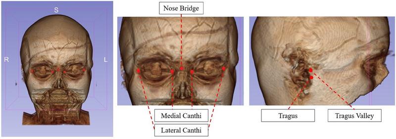 https://cdn.ncbi.nlm.nih.gov/pmc/blobs/5f37/12059523/53b2cb4eb926/MP-52-3481-g003.jpg