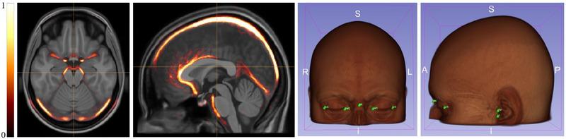 https://cdn.ncbi.nlm.nih.gov/pmc/blobs/5f37/12059523/5d75dc6c18db/MP-52-3481-g001.jpg