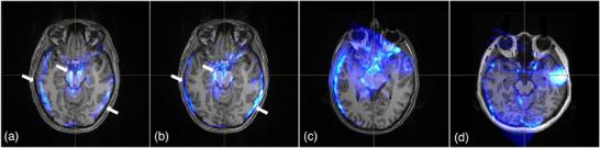 https://cdn.ncbi.nlm.nih.gov/pmc/blobs/5f37/12059523/8e1025c6cee6/MP-52-3481-g002.jpg