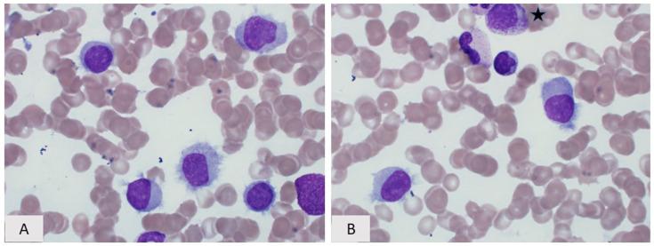 https://cdn.ncbi.nlm.nih.gov/pmc/blobs/5f3b/8700451/182842f98be9/curroncol-28-00430-g004.jpg