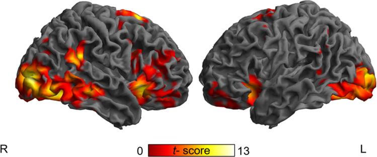 https://cdn.ncbi.nlm.nih.gov/pmc/blobs/5f3c/8825403/b5e2caa3071f/11682_2021_491_Fig2_HTML.jpg