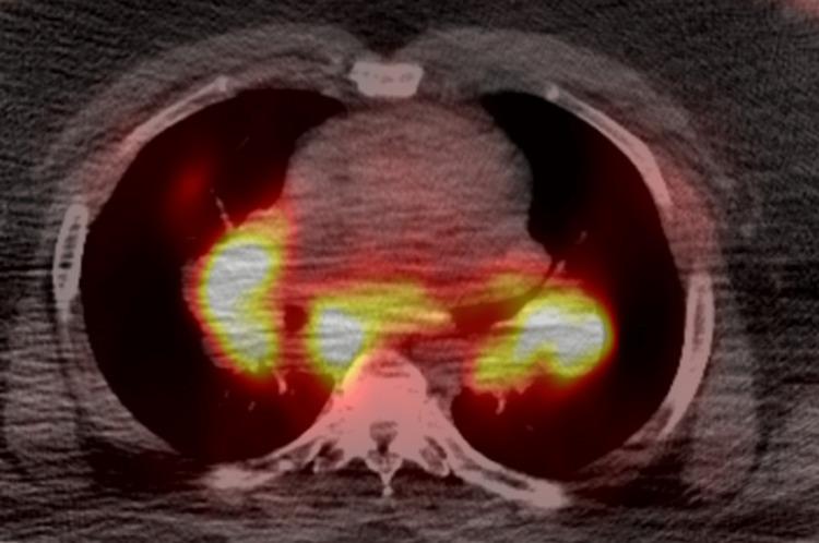 https://cdn.ncbi.nlm.nih.gov/pmc/blobs/5f3e/9948513/909cb8a45140/cureus-0015-00000034135-i03.jpg