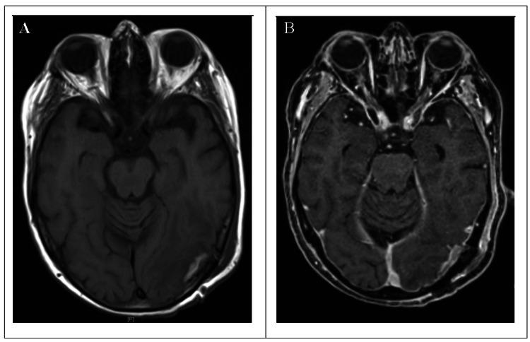 https://cdn.ncbi.nlm.nih.gov/pmc/blobs/5f45/10821756/917513eee0d1/cureus-0015-00000051231-i03.jpg