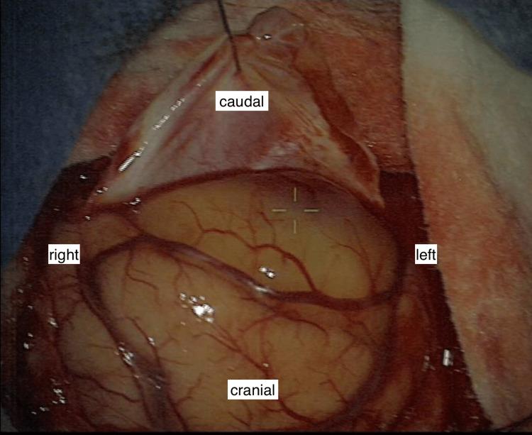 https://cdn.ncbi.nlm.nih.gov/pmc/blobs/5f45/10821756/d0d057333098/cureus-0015-00000051231-i02.jpg