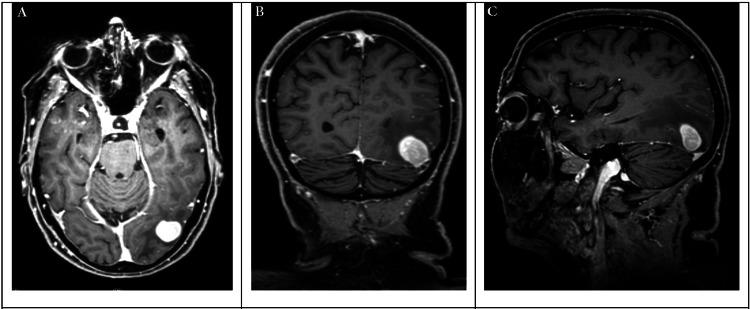 https://cdn.ncbi.nlm.nih.gov/pmc/blobs/5f45/10821756/e9dad224ee47/cureus-0015-00000051231-i01.jpg