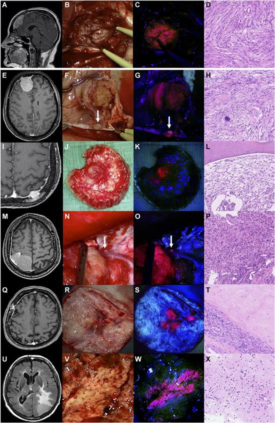 https://cdn.ncbi.nlm.nih.gov/pmc/blobs/5f46/8048546/2b8056699c61/LSM-53-300-g001.jpg