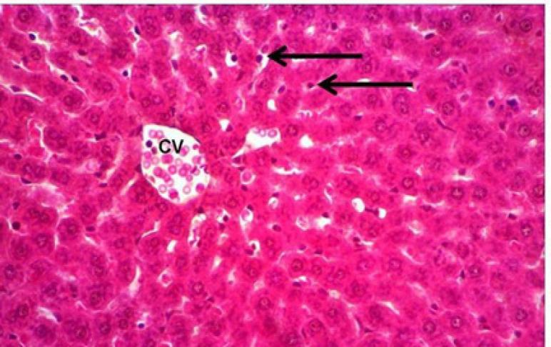 https://cdn.ncbi.nlm.nih.gov/pmc/blobs/5f48/8418846/4d6aedc17ce3/APJCP-22-1761-g004.jpg