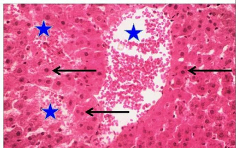 https://cdn.ncbi.nlm.nih.gov/pmc/blobs/5f48/8418846/59210b3a2811/APJCP-22-1761-g007.jpg