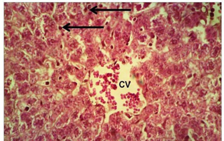 https://cdn.ncbi.nlm.nih.gov/pmc/blobs/5f48/8418846/5b2c0e6ab2f2/APJCP-22-1761-g006.jpg