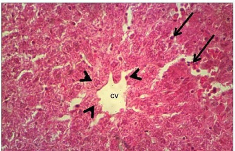 https://cdn.ncbi.nlm.nih.gov/pmc/blobs/5f48/8418846/a9fb3a70ac82/APJCP-22-1761-g002.jpg