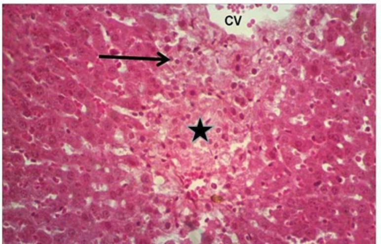 https://cdn.ncbi.nlm.nih.gov/pmc/blobs/5f48/8418846/c6fec35db165/APJCP-22-1761-g003.jpg