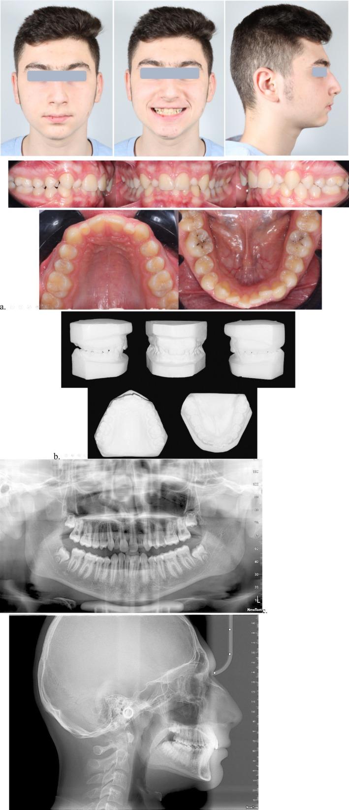 https://cdn.ncbi.nlm.nih.gov/pmc/blobs/5f49/12079472/afb14521fee5/CCR3-13-e70509-g002.jpg