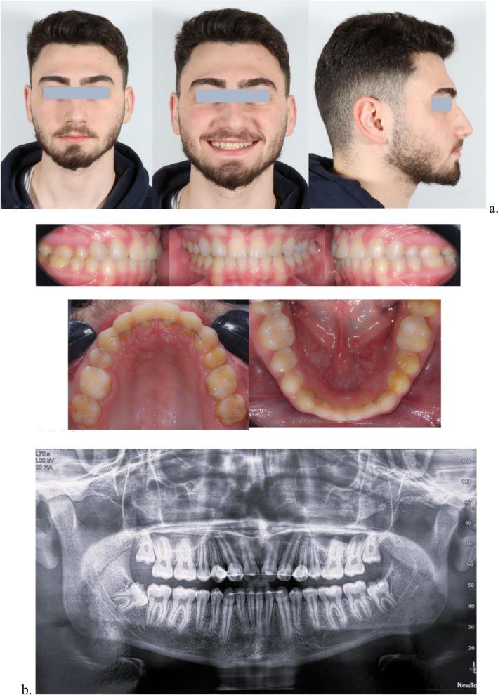 https://cdn.ncbi.nlm.nih.gov/pmc/blobs/5f49/12079472/b8754d2f4179/CCR3-13-e70509-g003.jpg