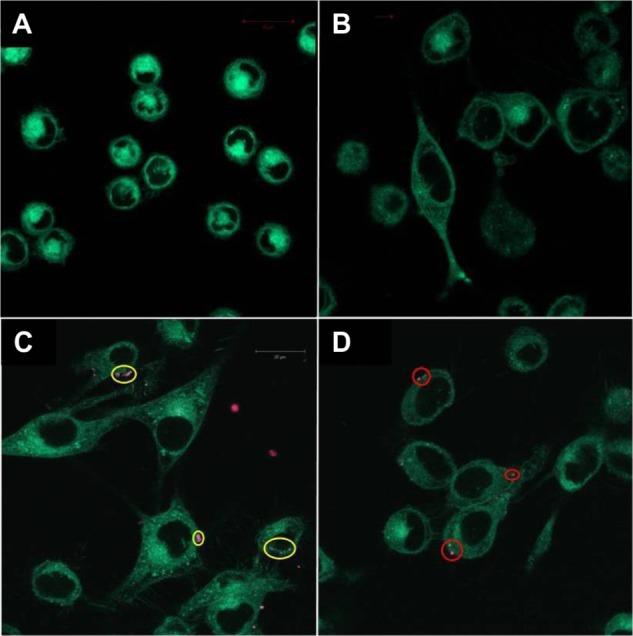 https://cdn.ncbi.nlm.nih.gov/pmc/blobs/5f50/3862508/412fb71b305e/ijn-8-4659Fig1.jpg