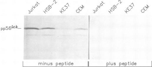 https://cdn.ncbi.nlm.nih.gov/pmc/blobs/5f5a/553696/4d75bc47ba57/emboj00249-0218-b.jpg