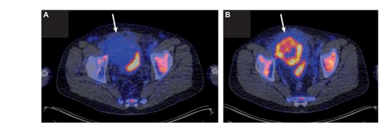 https://cdn.ncbi.nlm.nih.gov/pmc/blobs/5f5b/11298440/2baca7db4418/fmed-11-1233913-g003.jpg