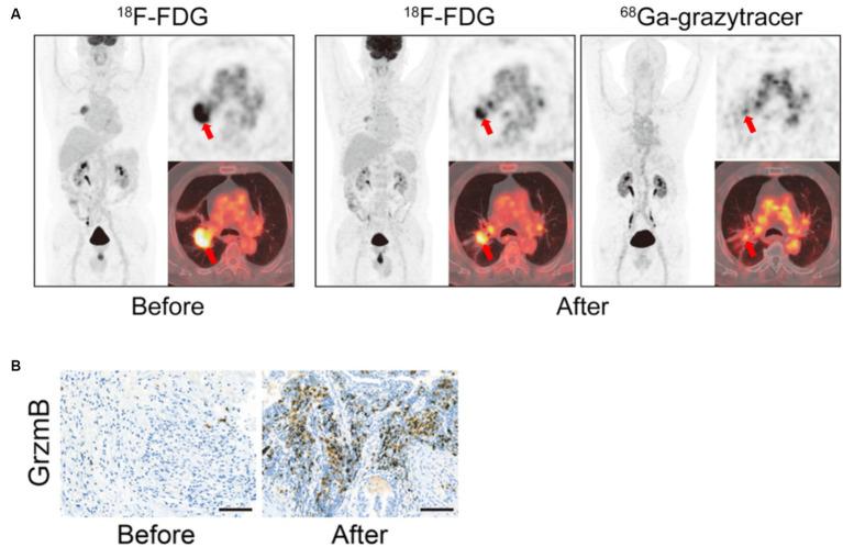 https://cdn.ncbi.nlm.nih.gov/pmc/blobs/5f5b/11298440/fd6339b4b19b/fmed-11-1233913-g005.jpg