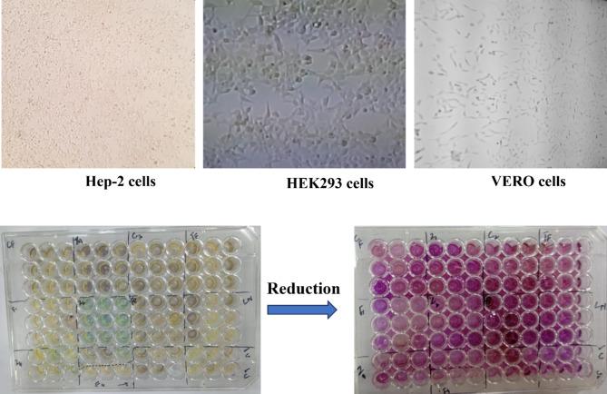 https://cdn.ncbi.nlm.nih.gov/pmc/blobs/5f5c/12008411/3ae2fec2bce6/41598_2025_87670_Fig10_HTML.jpg