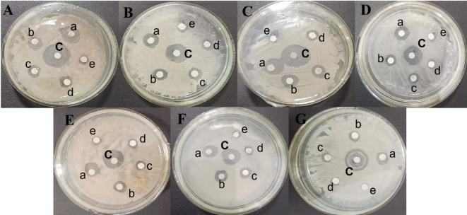 https://cdn.ncbi.nlm.nih.gov/pmc/blobs/5f5c/12008411/6e65085323fb/41598_2025_87670_Fig8_HTML.jpg