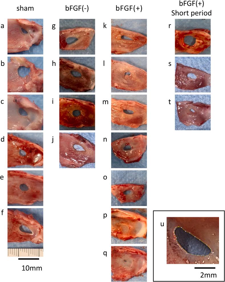 https://cdn.ncbi.nlm.nih.gov/pmc/blobs/5f60/10901693/d0eb0ea10d22/gr2.jpg