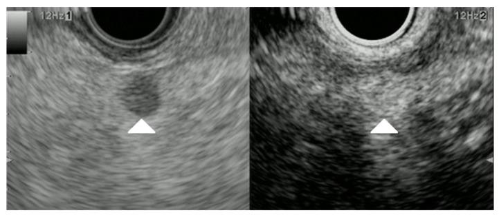 https://cdn.ncbi.nlm.nih.gov/pmc/blobs/5f61/10177255/5d4ca44d57c8/cancers-15-02546-g008.jpg