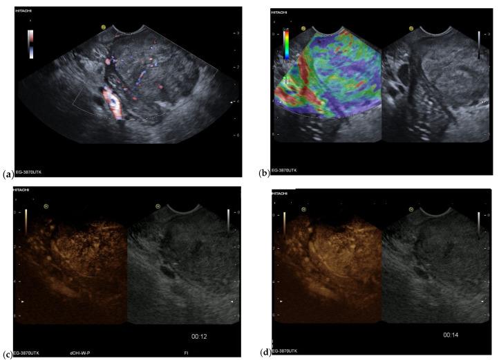 https://cdn.ncbi.nlm.nih.gov/pmc/blobs/5f61/10177255/dab85109b405/cancers-15-02546-g009.jpg