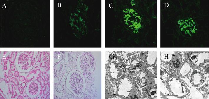 https://cdn.ncbi.nlm.nih.gov/pmc/blobs/5f66/12021926/8e5080a4eb10/fimmu-16-1551094-g001.jpg