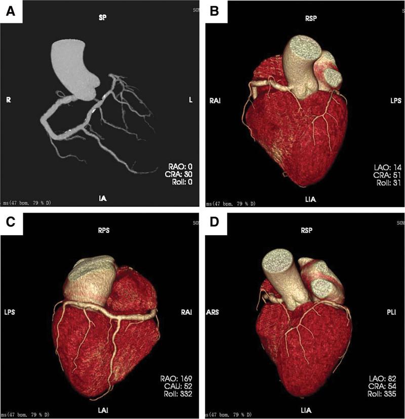 https://cdn.ncbi.nlm.nih.gov/pmc/blobs/5f68/11296457/d9f7b3b5b80e/medi-103-e39143-g002.jpg