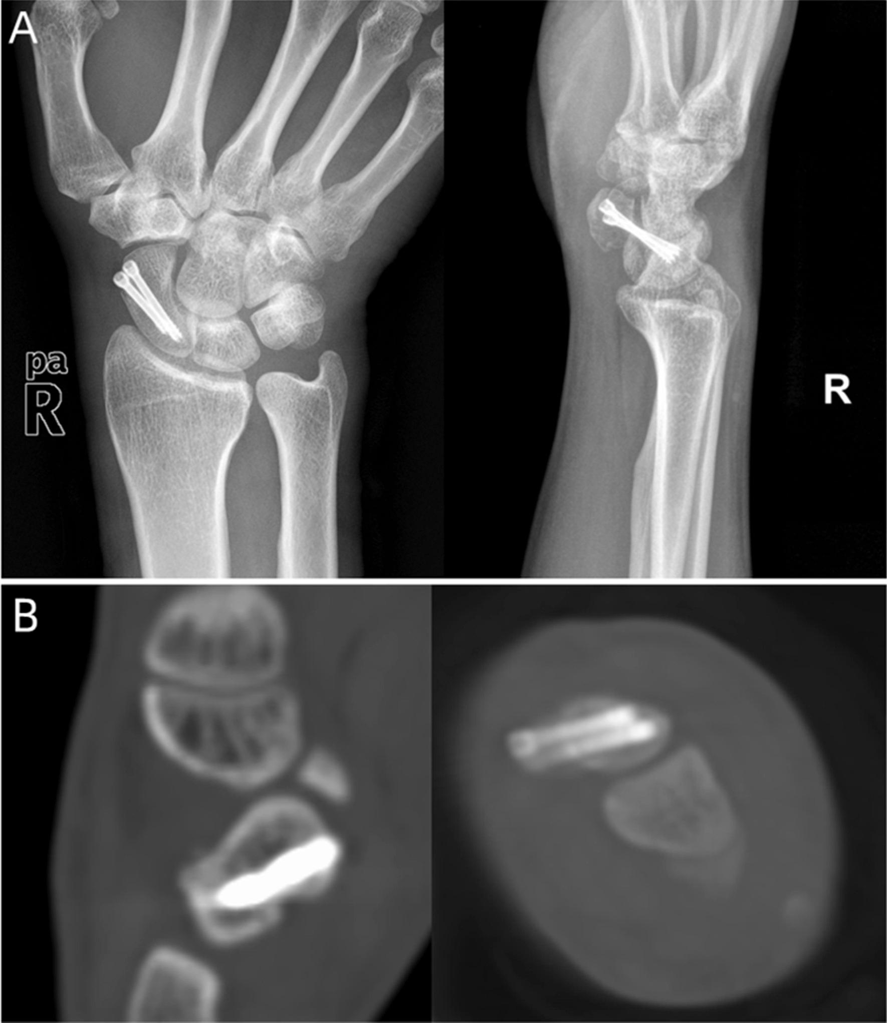 https://cdn.ncbi.nlm.nih.gov/pmc/blobs/5f68/9847075/fd0ebe22afe6/13018_2023_3529_Fig4_HTML.jpg