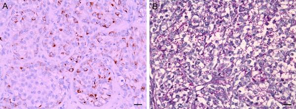 https://cdn.ncbi.nlm.nih.gov/pmc/blobs/5f77/2887404/27b27dc74771/1471-2407-10-243-1.jpg