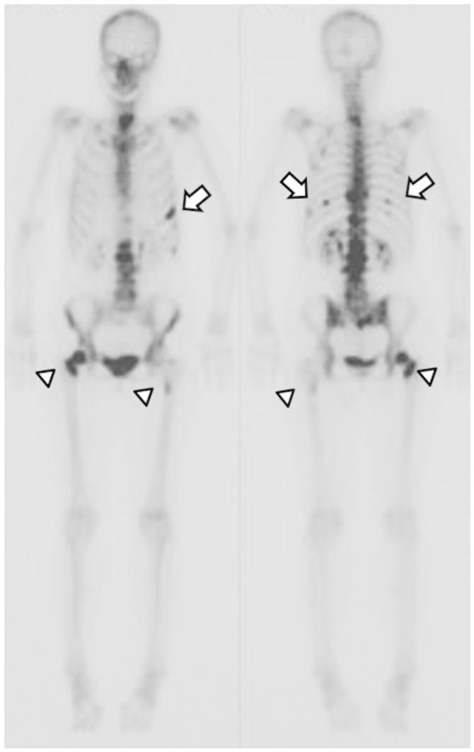 https://cdn.ncbi.nlm.nih.gov/pmc/blobs/5f77/4151632/03508aa3bb8a/ETM-08-04-1267-g01.jpg
