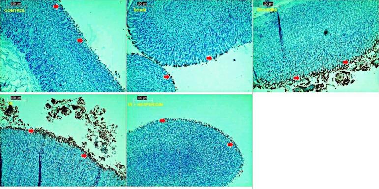 https://cdn.ncbi.nlm.nih.gov/pmc/blobs/5f78/10926971/2218c5b0fc92/1678-2674-acb-39-e391124-gf03.jpg